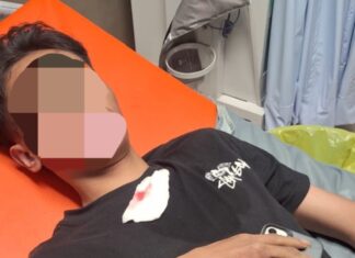 Remaja di Bantul Alami Luka Bacok Akibat Sabetan Celurit oleh OTK
